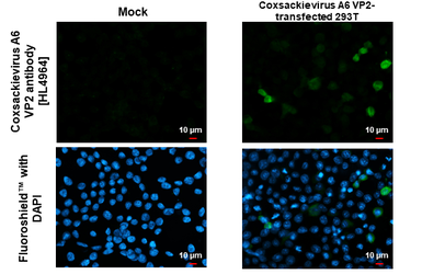 Anti-Coxsackievirus A6 VP2 antibody [HL4965] used in Immunocytochemistry/ Immunofluorescence (ICC/IF). GTX645051